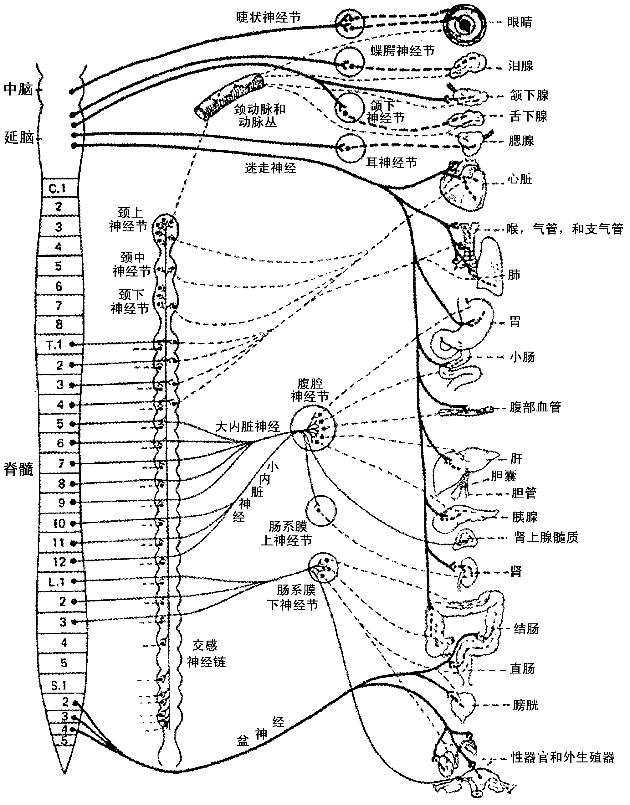 Methods and apparatus for renal neuromodulation via stereotactic radiotherapy