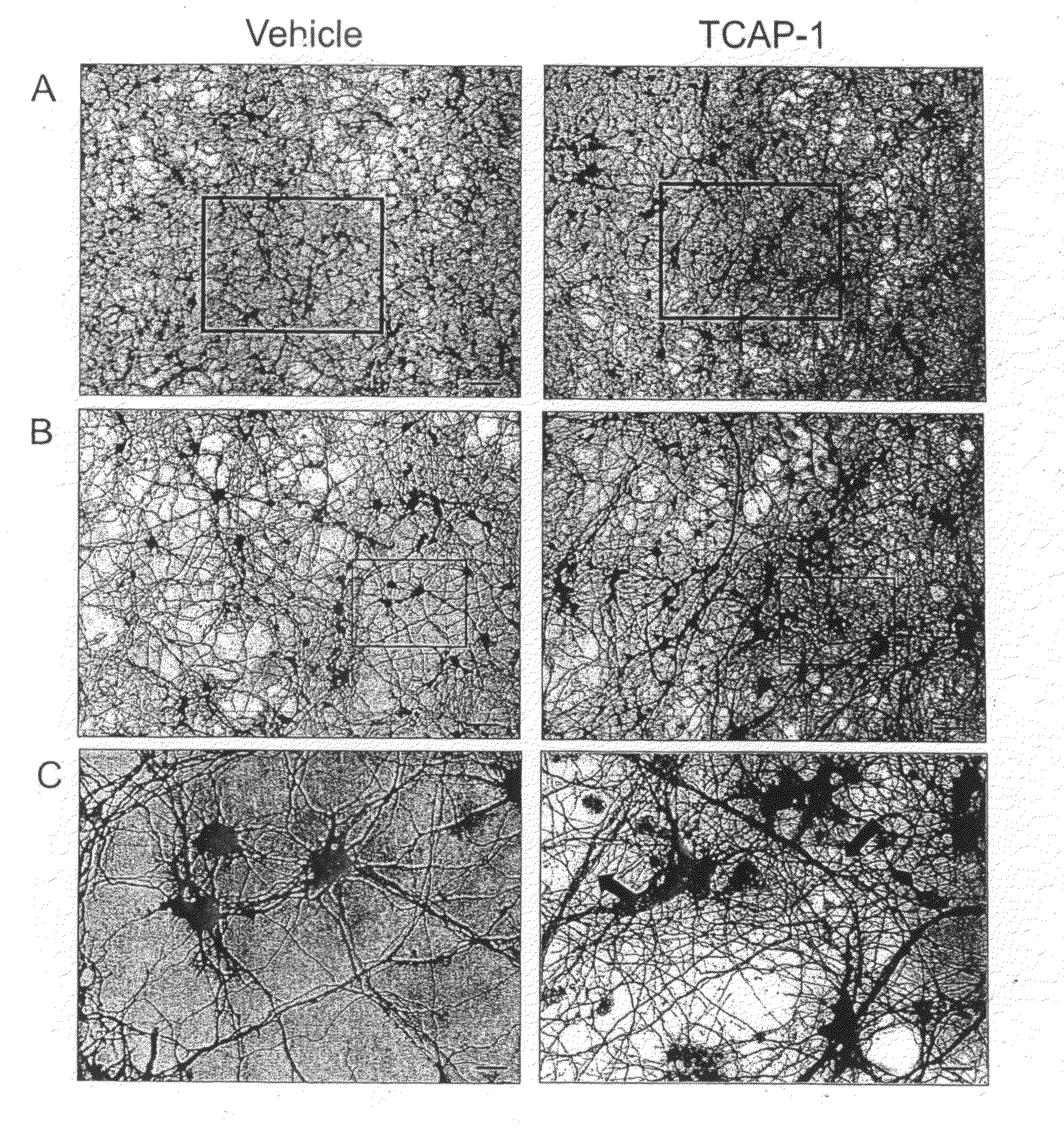 Method for regulating neurite growth