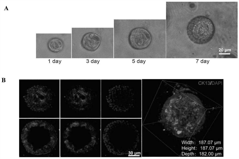 Method for constructing orthotopic primary endometrial cancer animal model