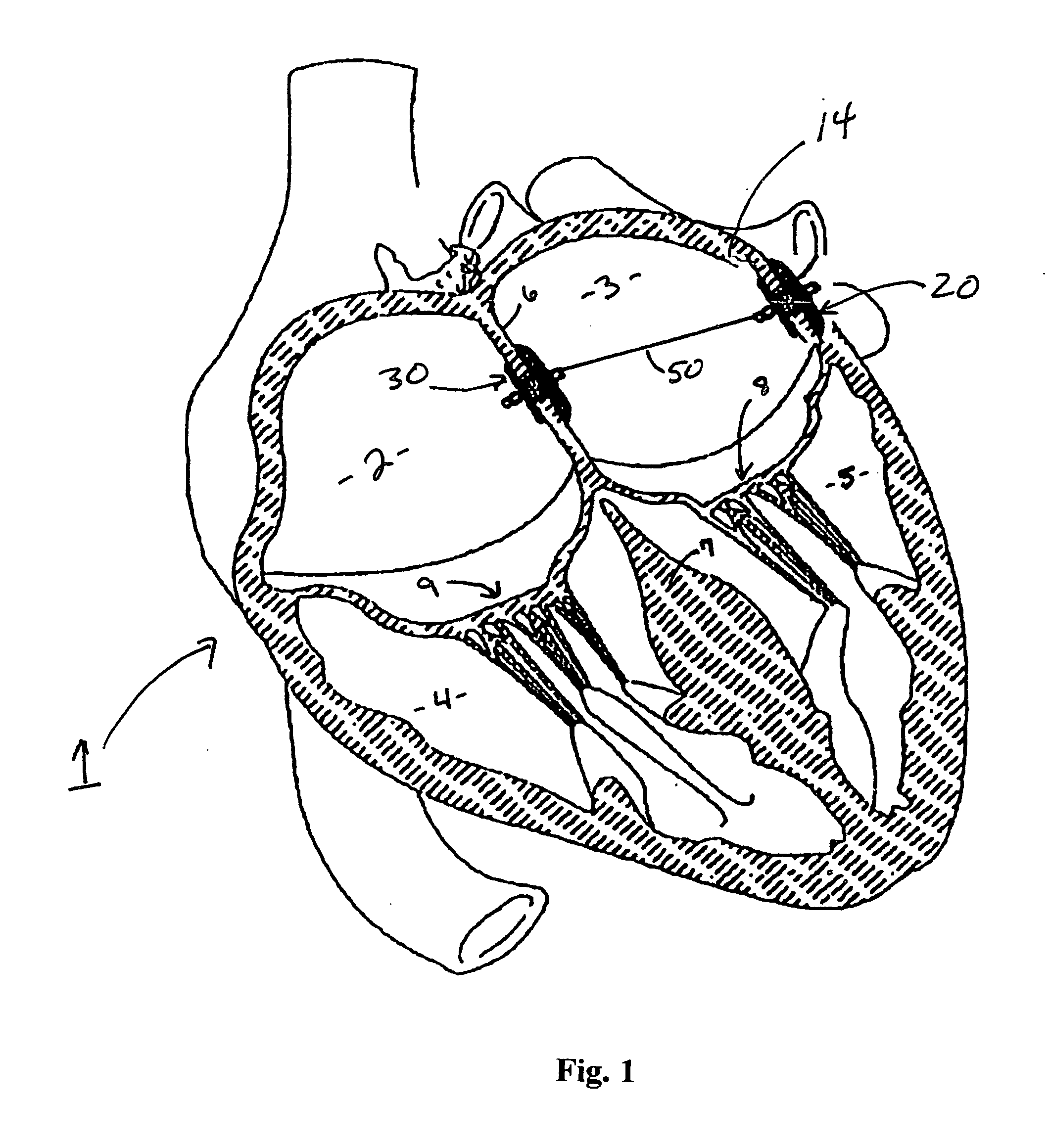 Anchoring and tethering system