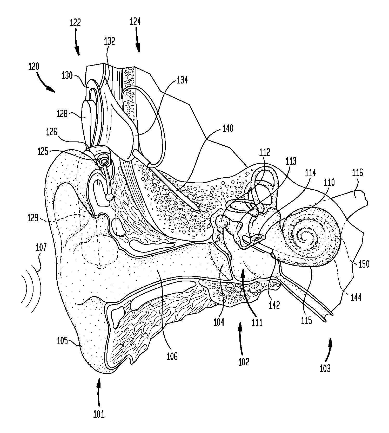 Complimentary drug delivery sheath for an implantable medical device