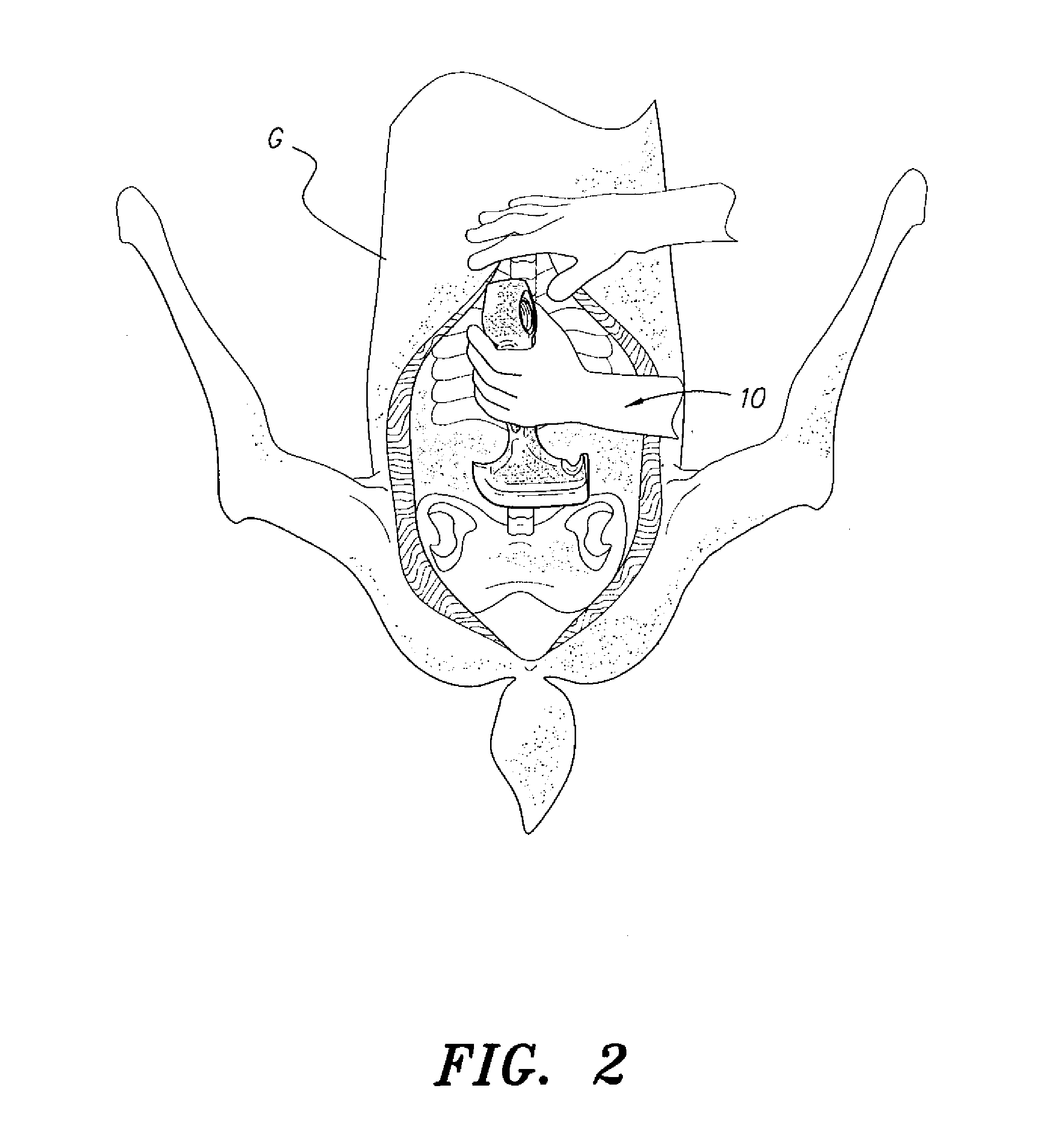 Game field dressing tool