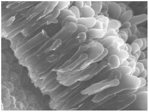 Electrolyte and lithium metal battery