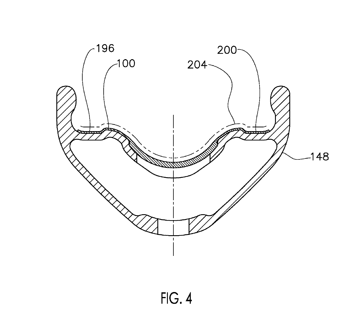 Rim with recessed channel and rim strip apparatus and system