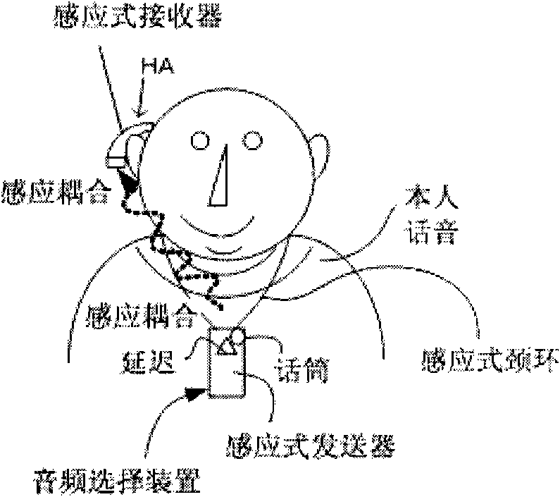 A device for treatment of stuttering and its use