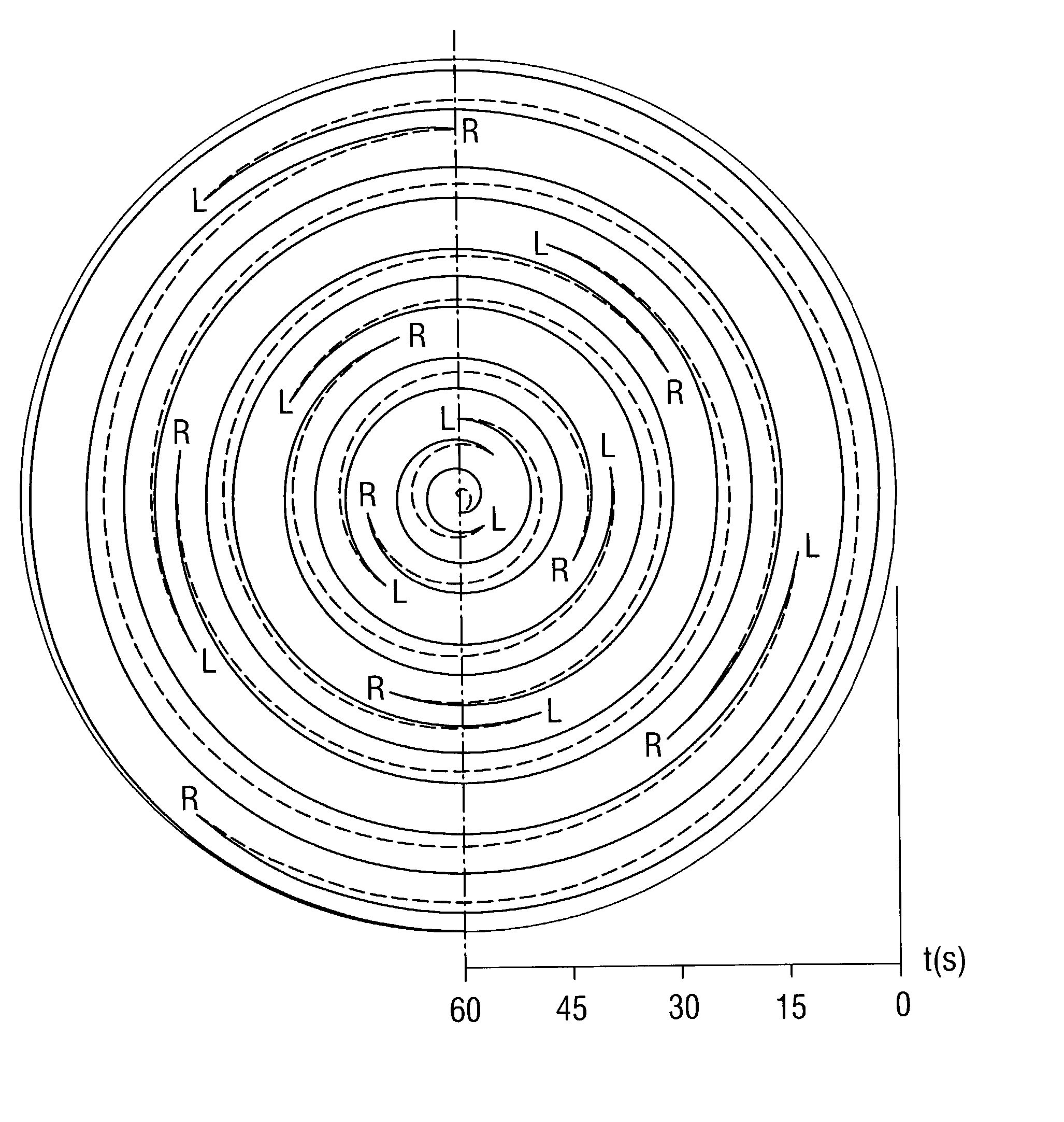 Silicon single crystal produced by crucible-free float zone pulling