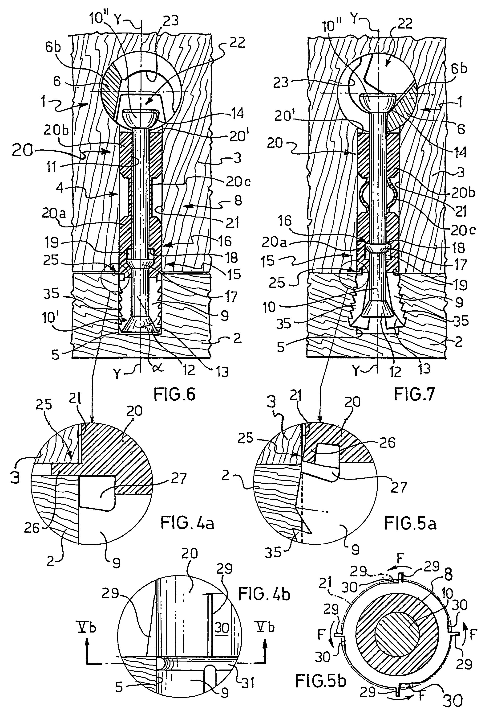 Device and method for detachably connecting abutting structural parts and tie member for use to form said device