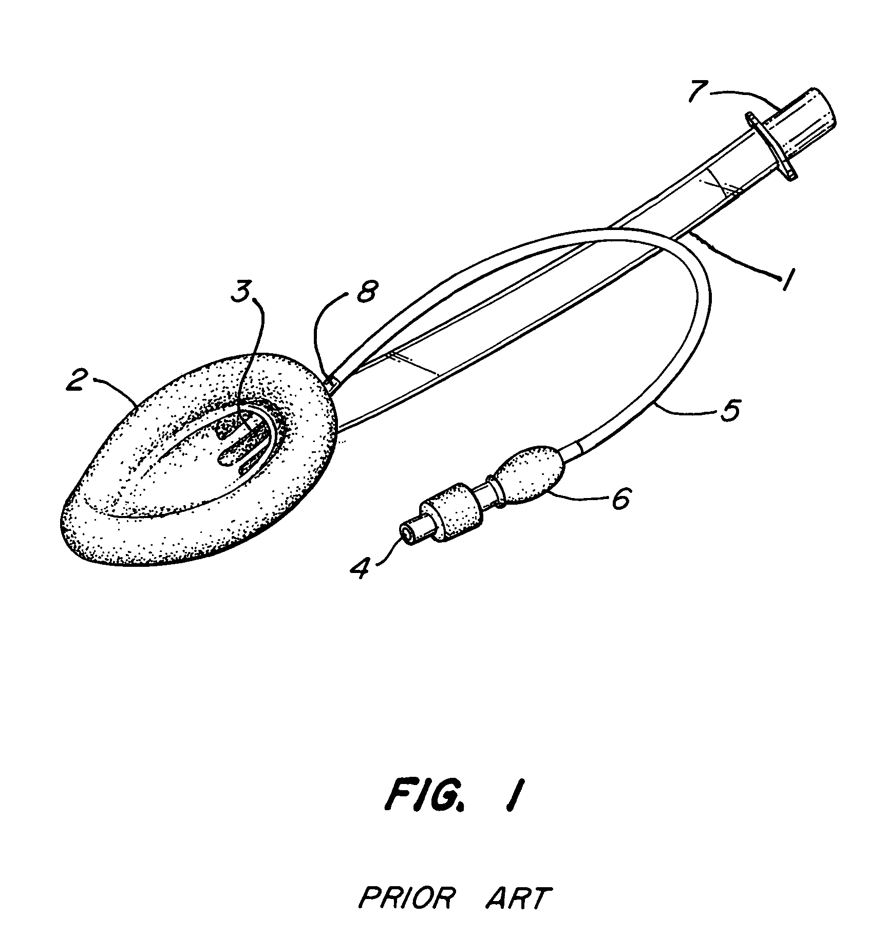 Laryngeal airway device