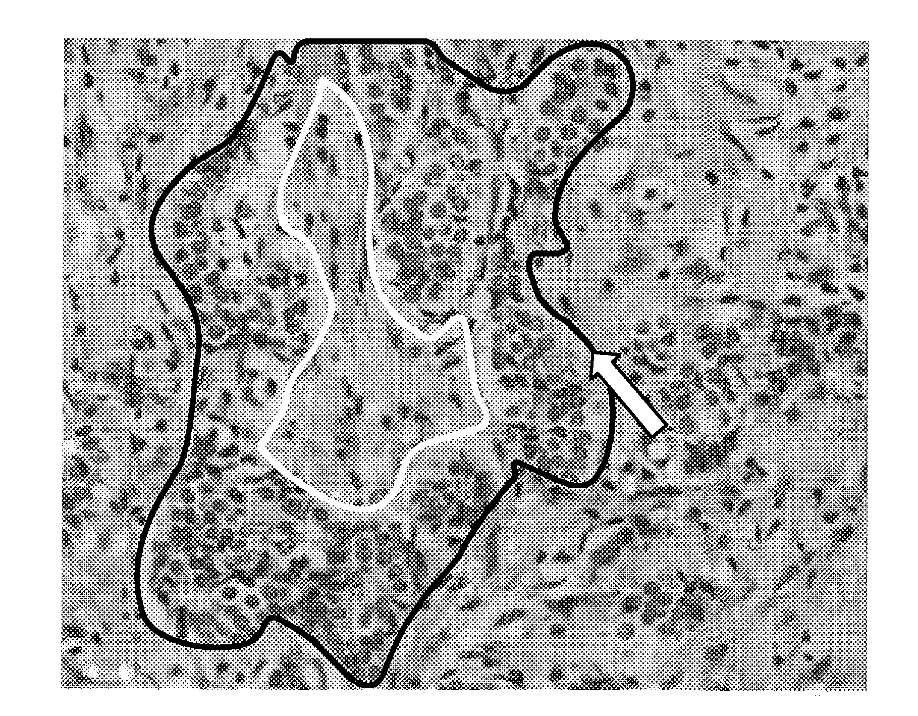 Medical image processor and storage medium