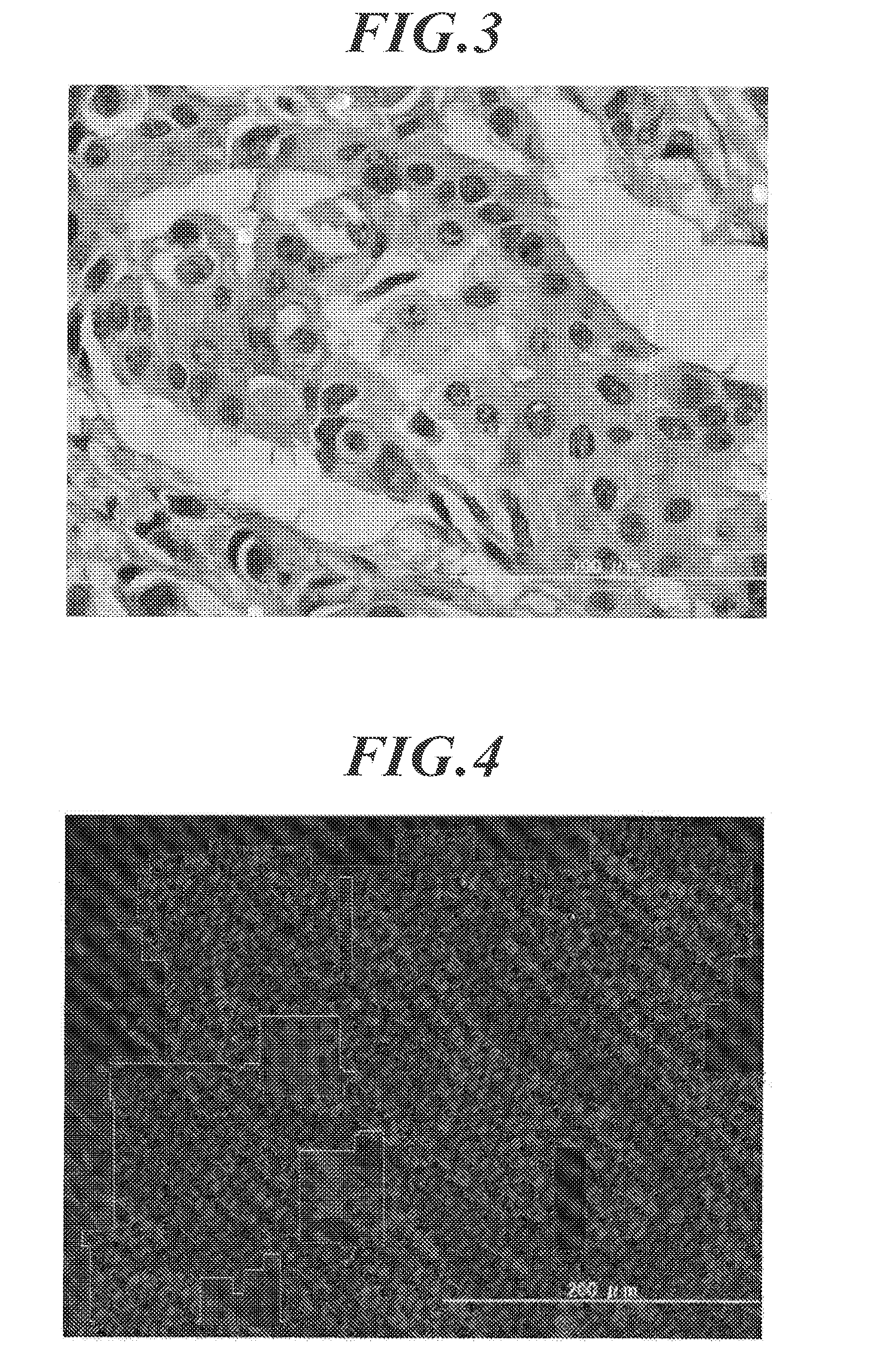 Medical image processor and storage medium