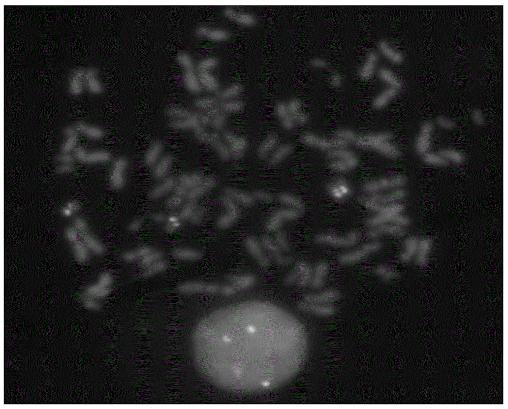 TOP2A gene detection probe, preparation method thereof and reagent kit