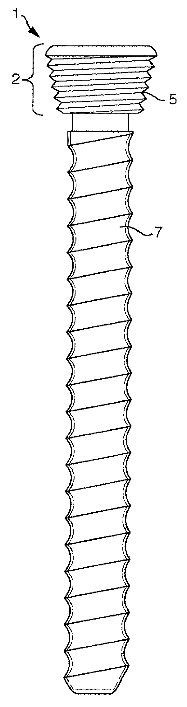 Locking fixation system and lag tool