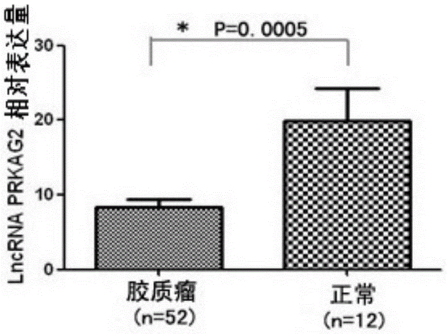 Application method of long-chain non-coding rna PRKAG2-AS1 derived from serum exosomes