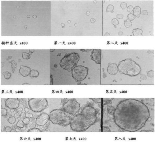 Method for preparing human chorionic stem cell culture solution and application thereof