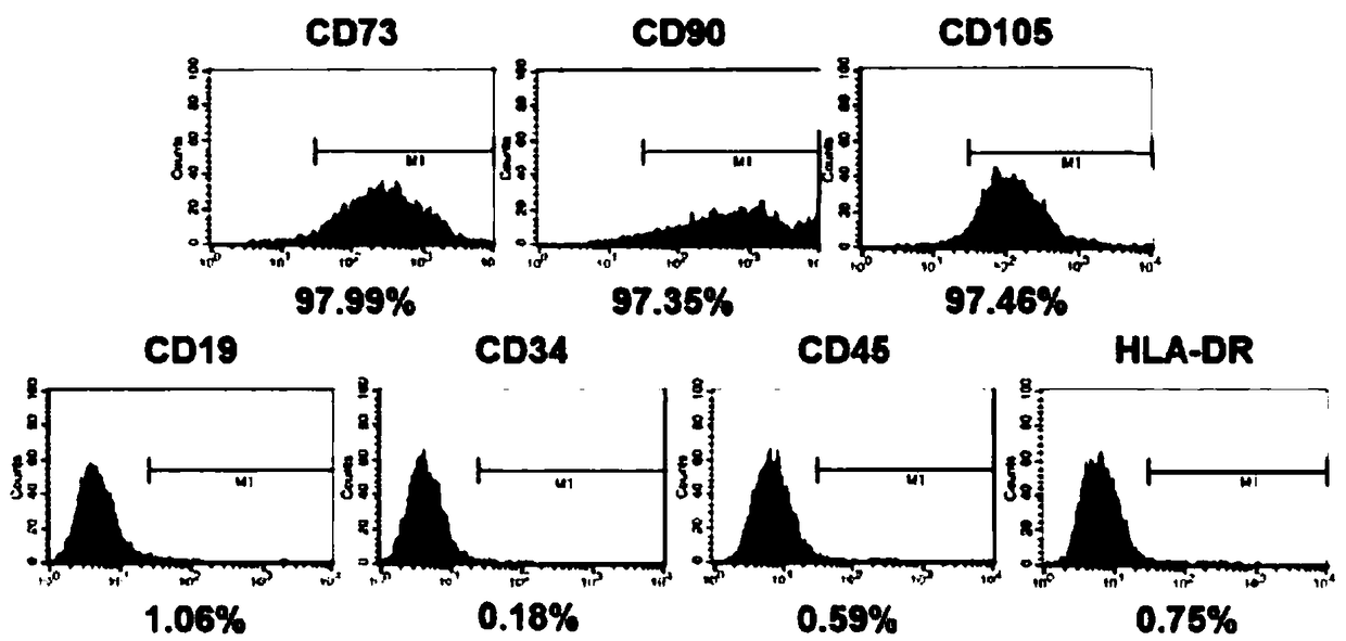 Method for preparing human chorionic stem cell culture solution and application thereof