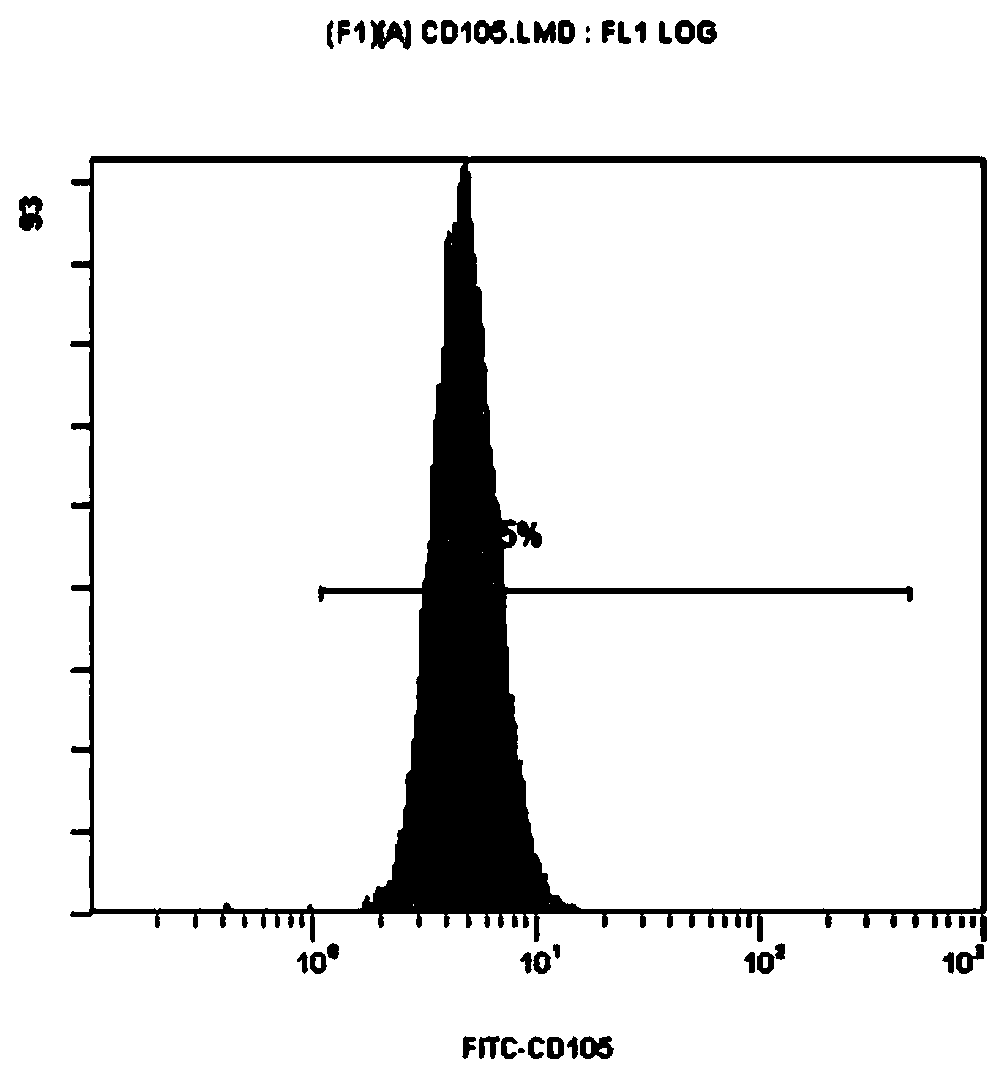 Method for inducing human umbilical cord derived mesenchymal stem cells to differentiate into chondrocytes and application thereof