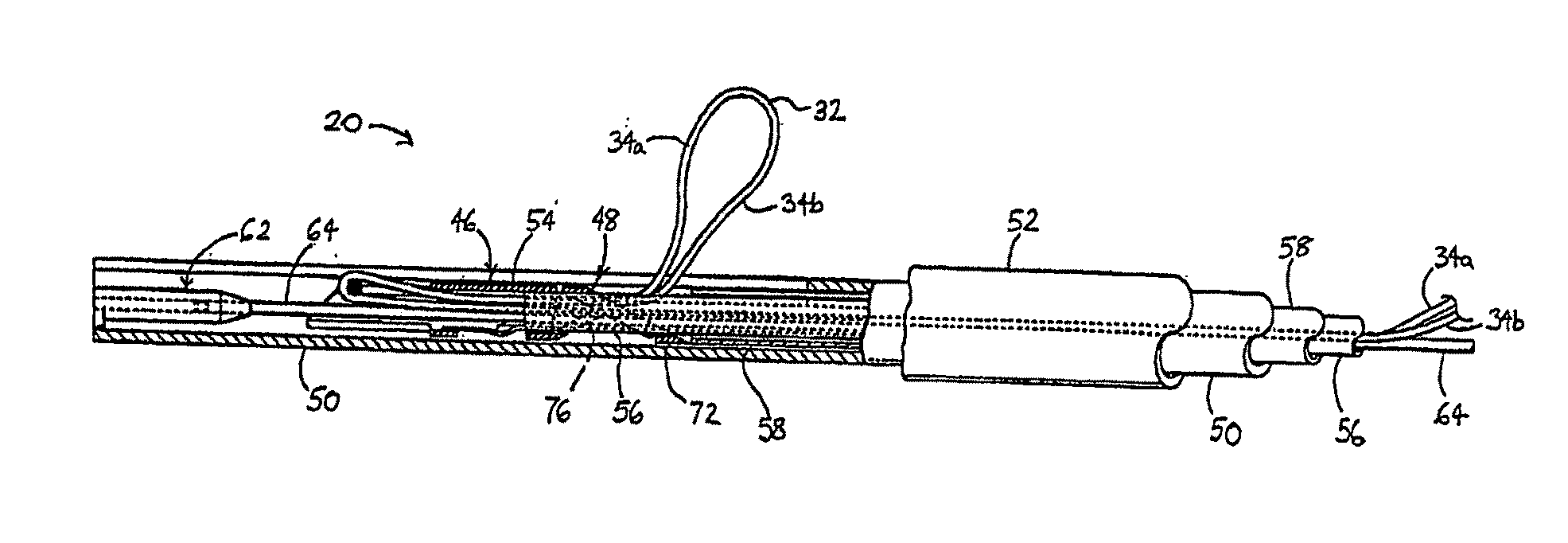 Knotless suture anchoring device having deforming section to accommodate sutures of various diameters