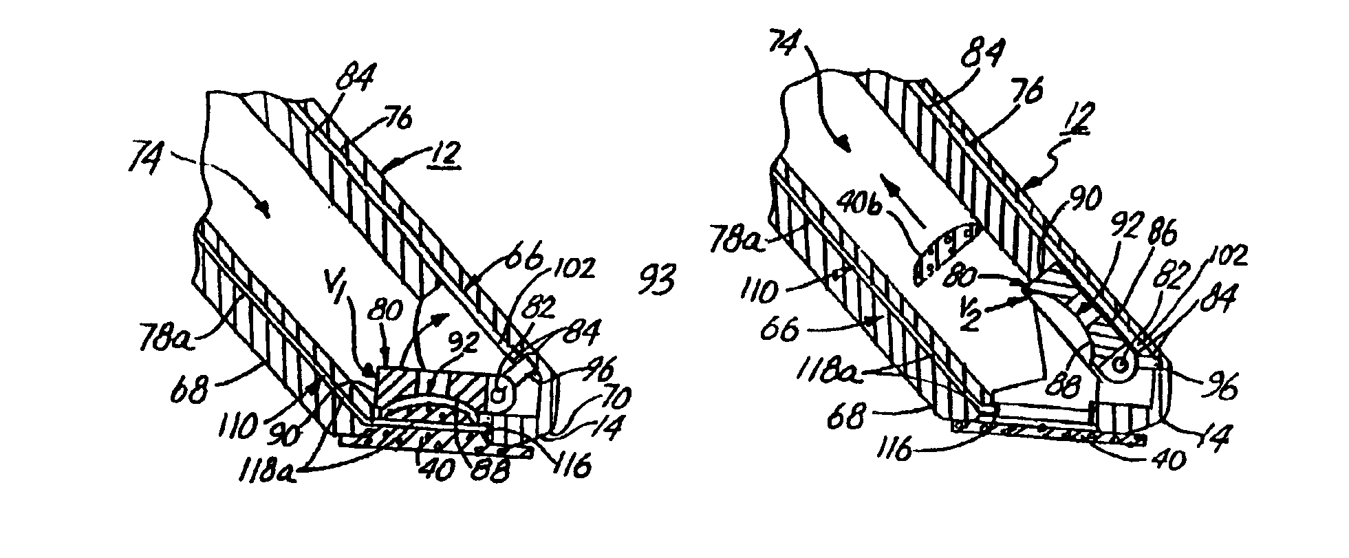 Bipolar RF excision and aspiration device and method for endometriosis removal