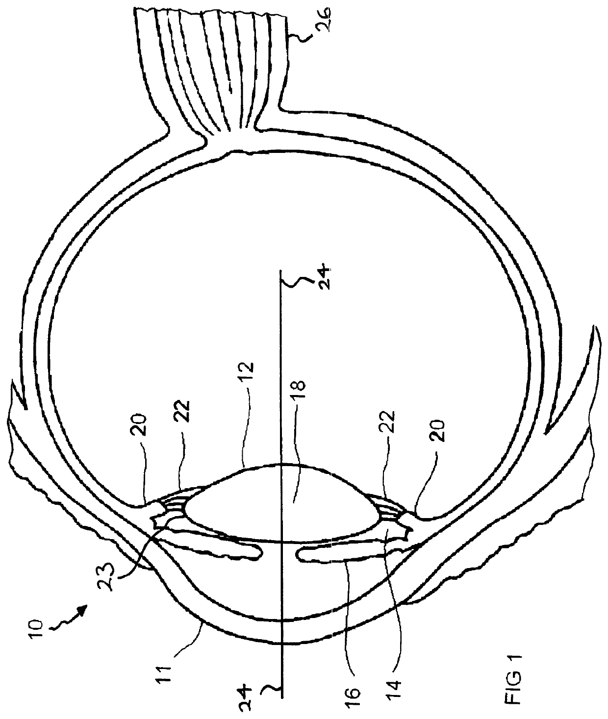 Accommodating intraocular lens systems and intraocular lens focusers