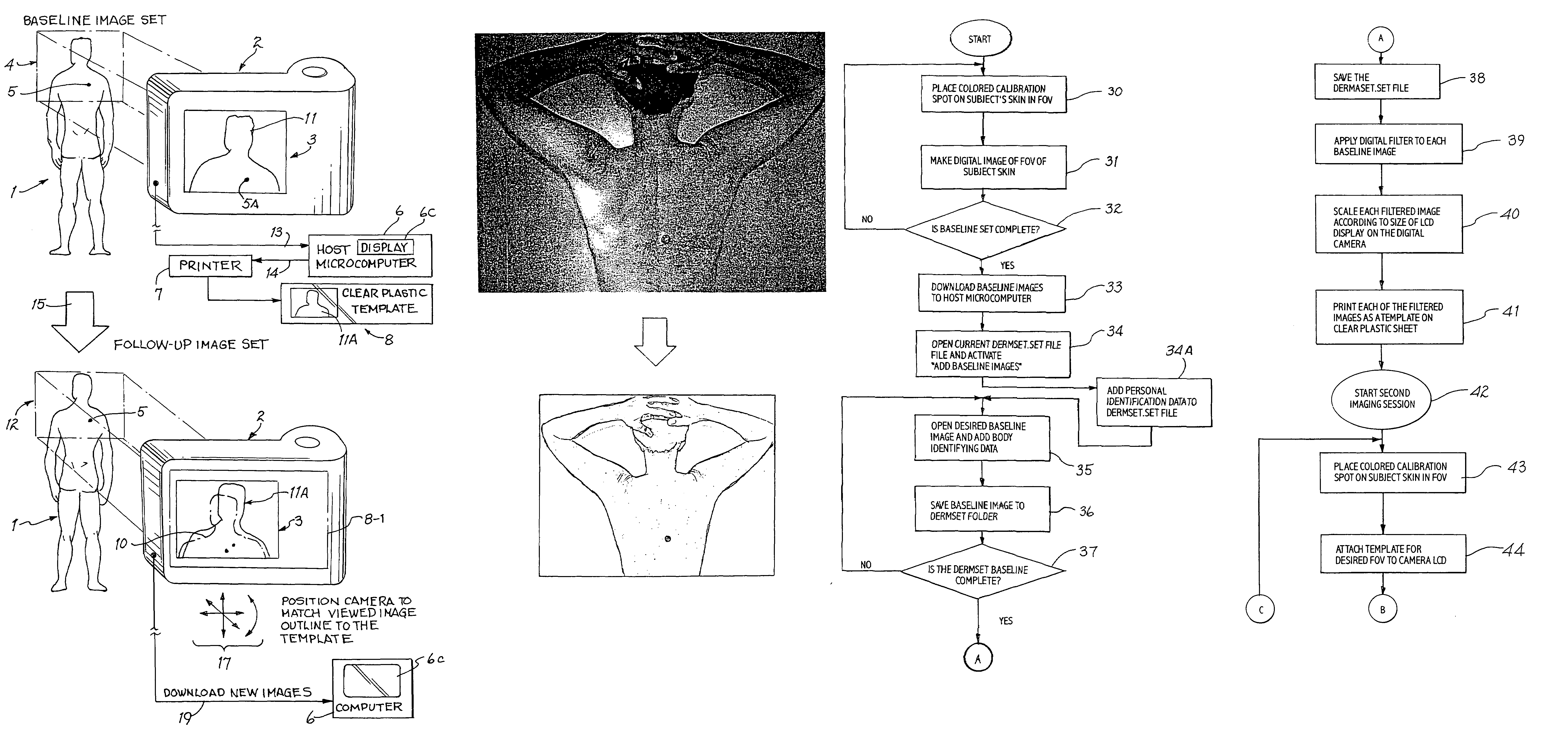 Digital skin lesion imaging system and method