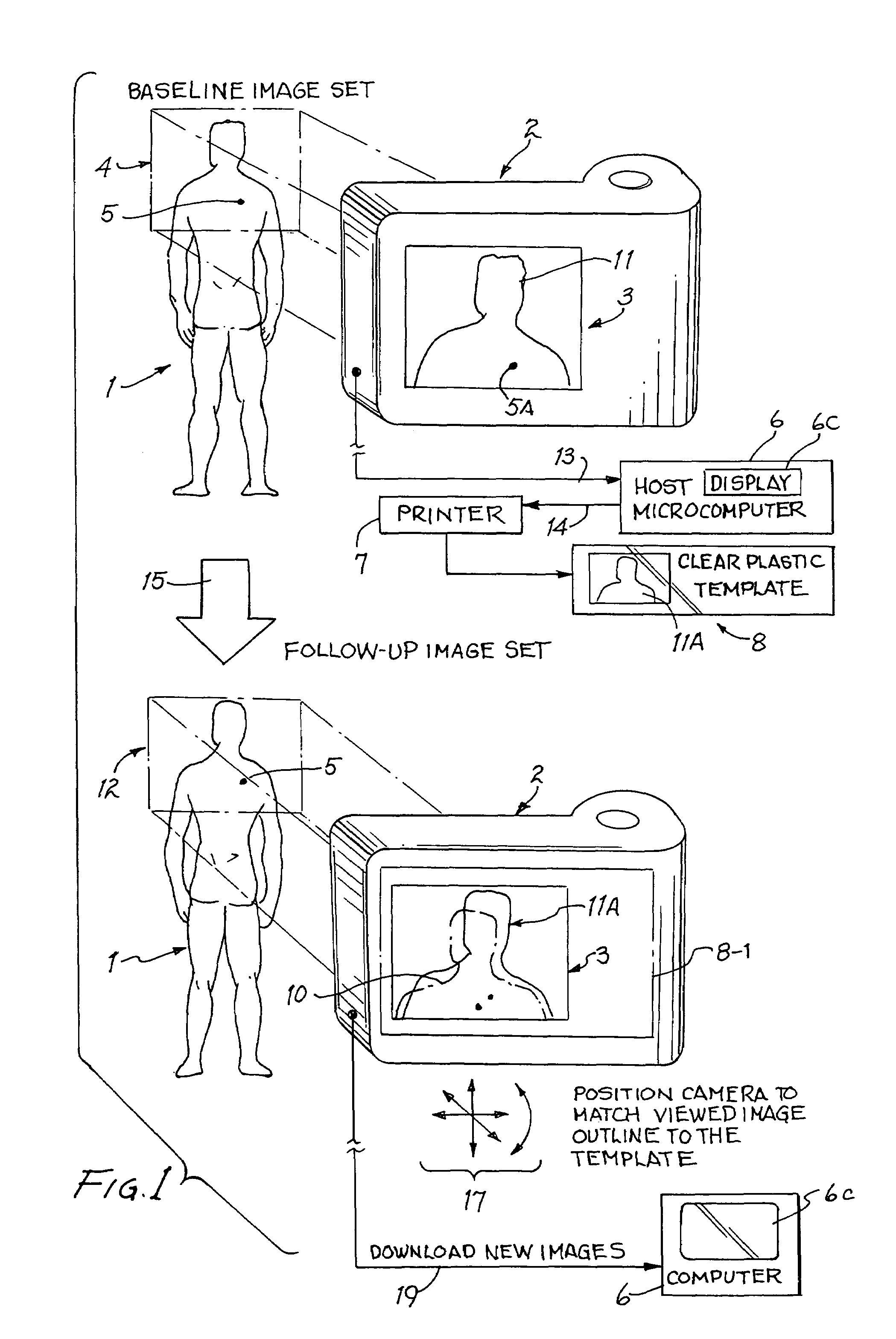 Digital skin lesion imaging system and method