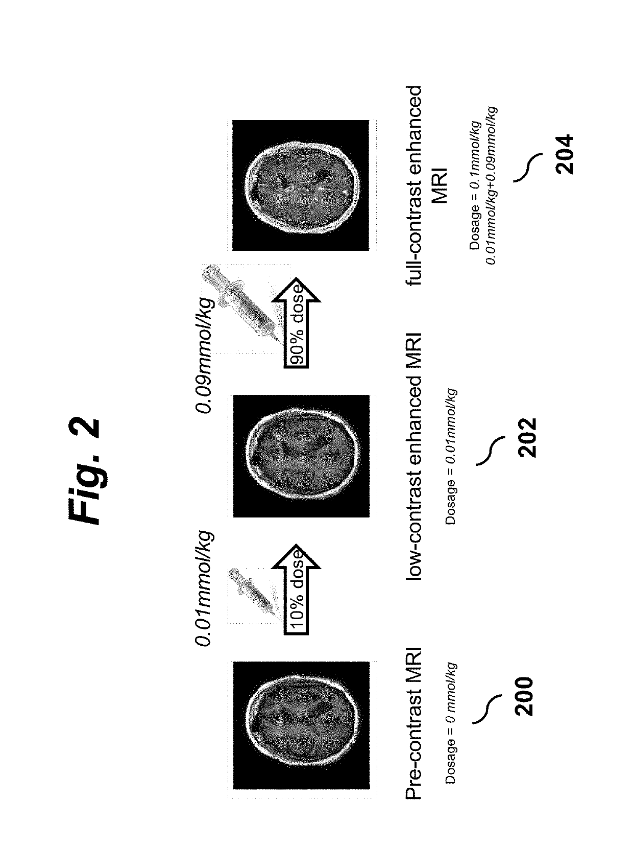 Contrast Dose Reduction for Medical Imaging Using Deep Learning