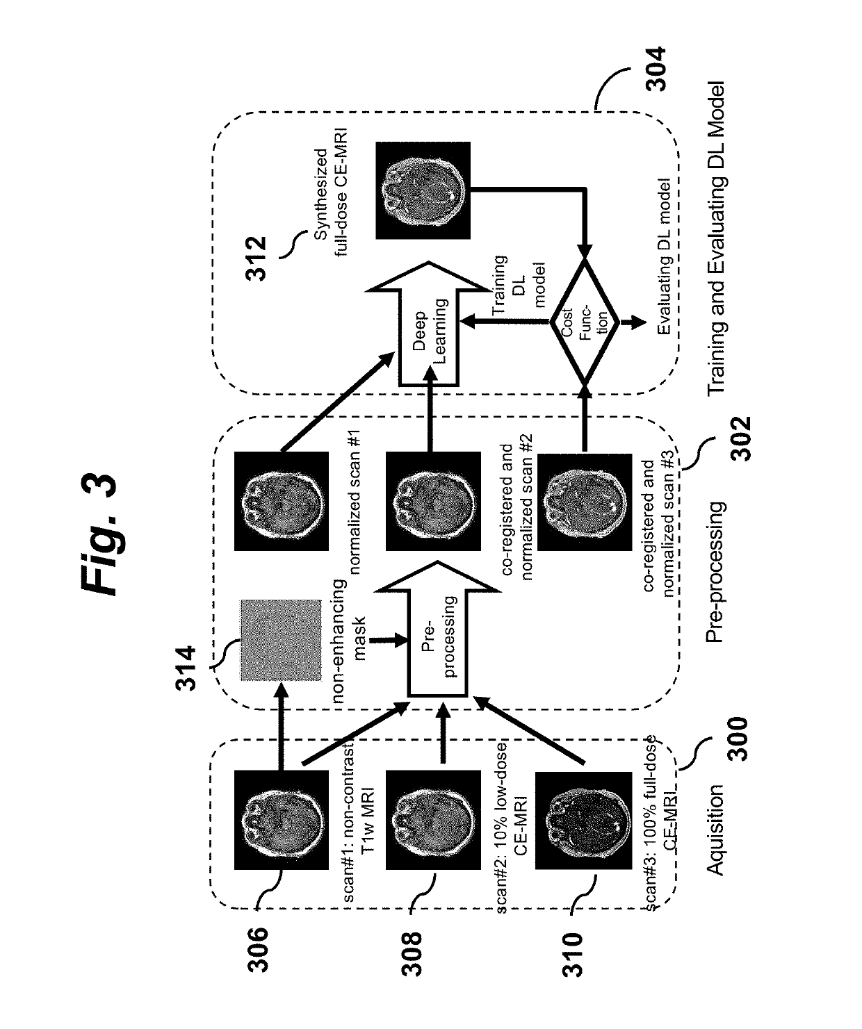 Contrast Dose Reduction for Medical Imaging Using Deep Learning