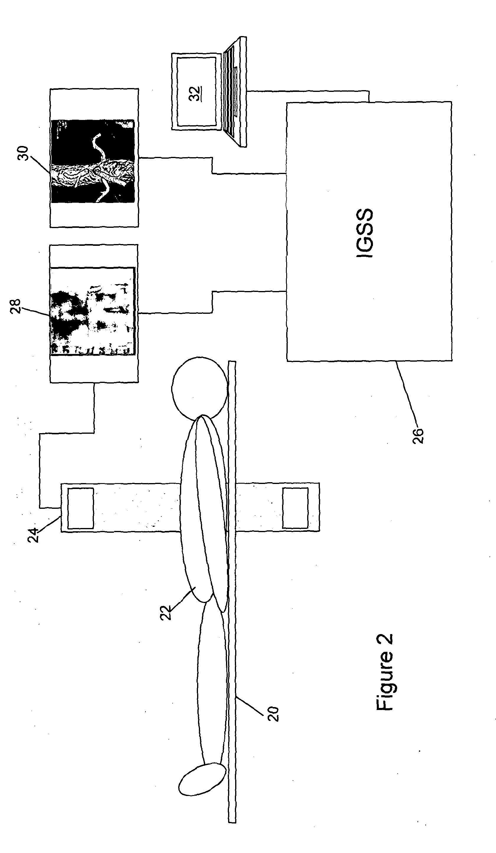 Virtual fiducial markers