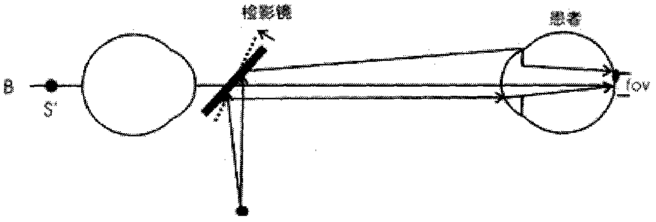 Digital retinoscopy optometry system