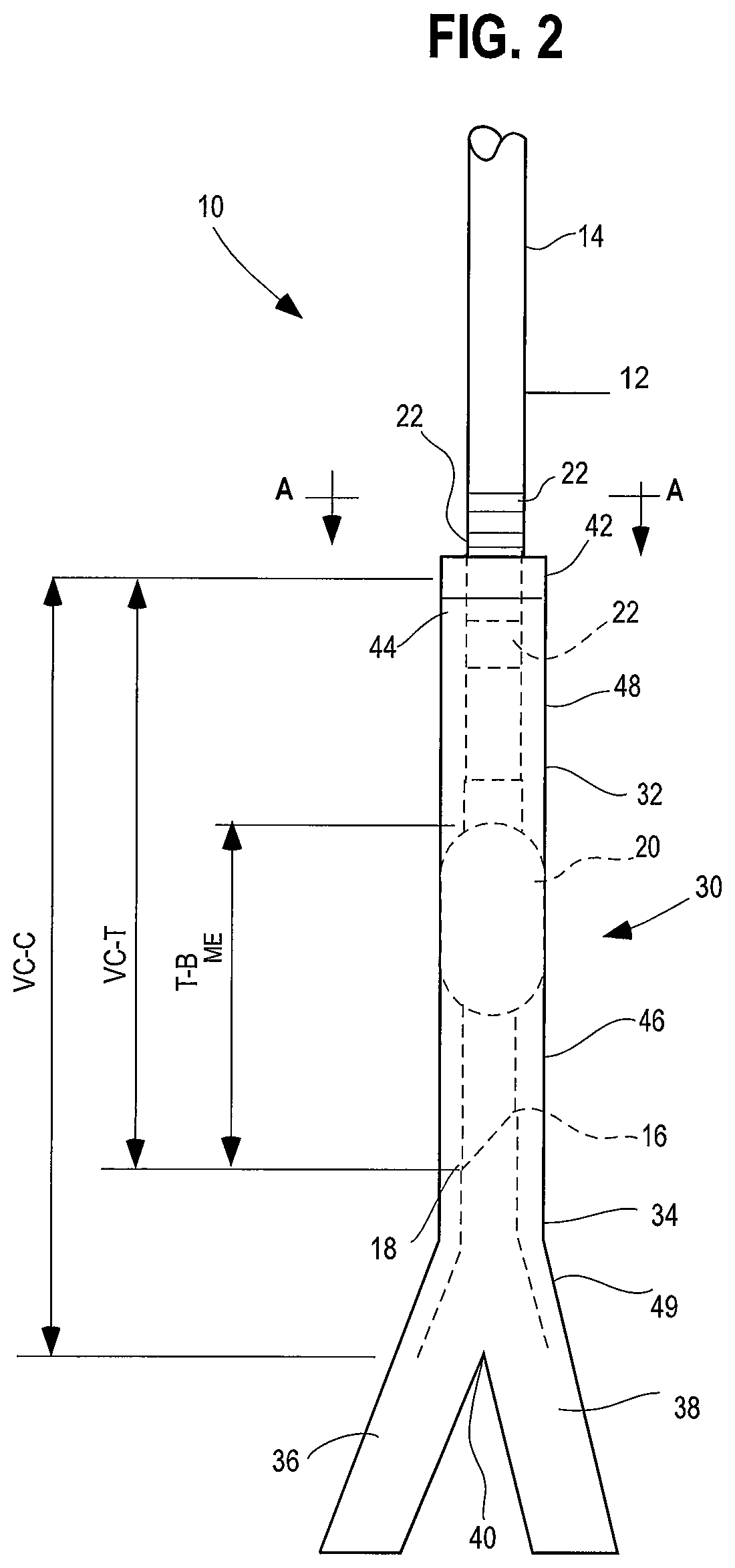 Method and apparatus for determining optimal endotracheal tube size