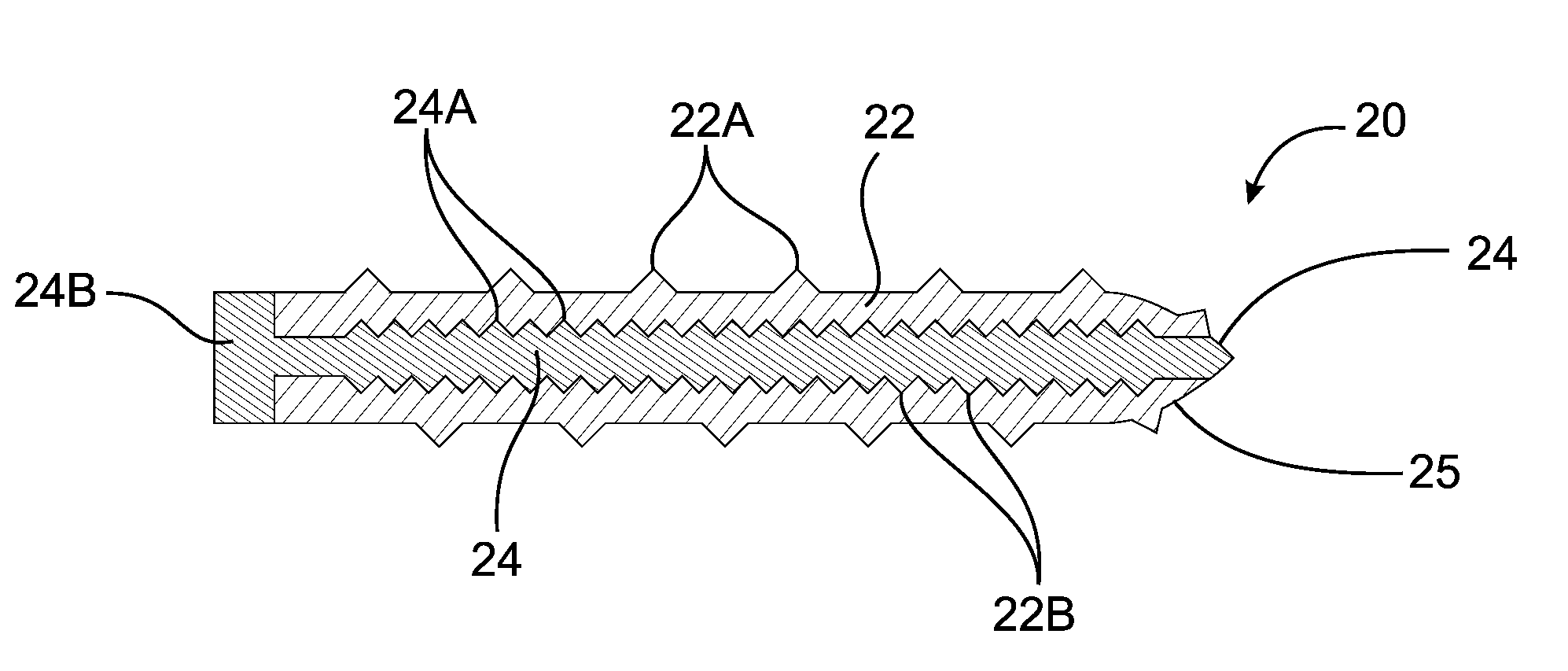 Subcutaneous implantable device for gradually aligning a spine and subcutaneous implantable device for gradually lengthening a bone