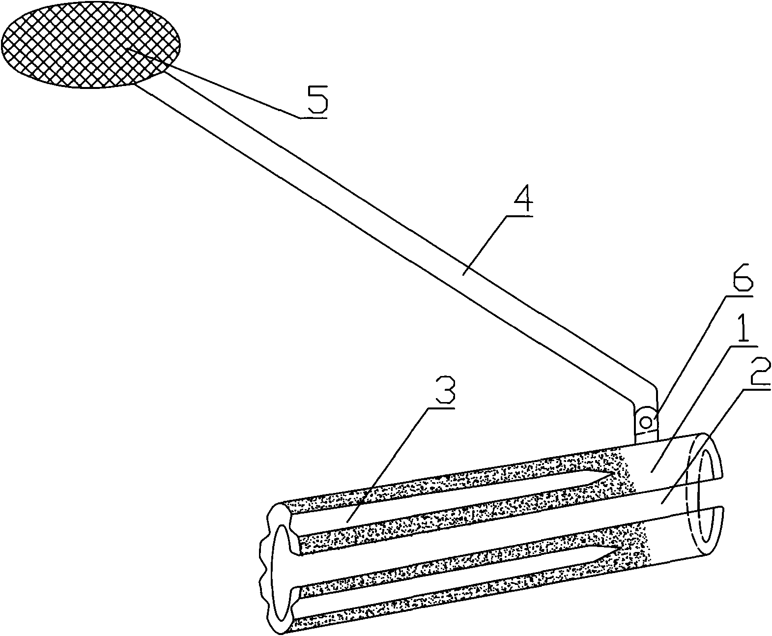 Removable micro anastomosis sleeve