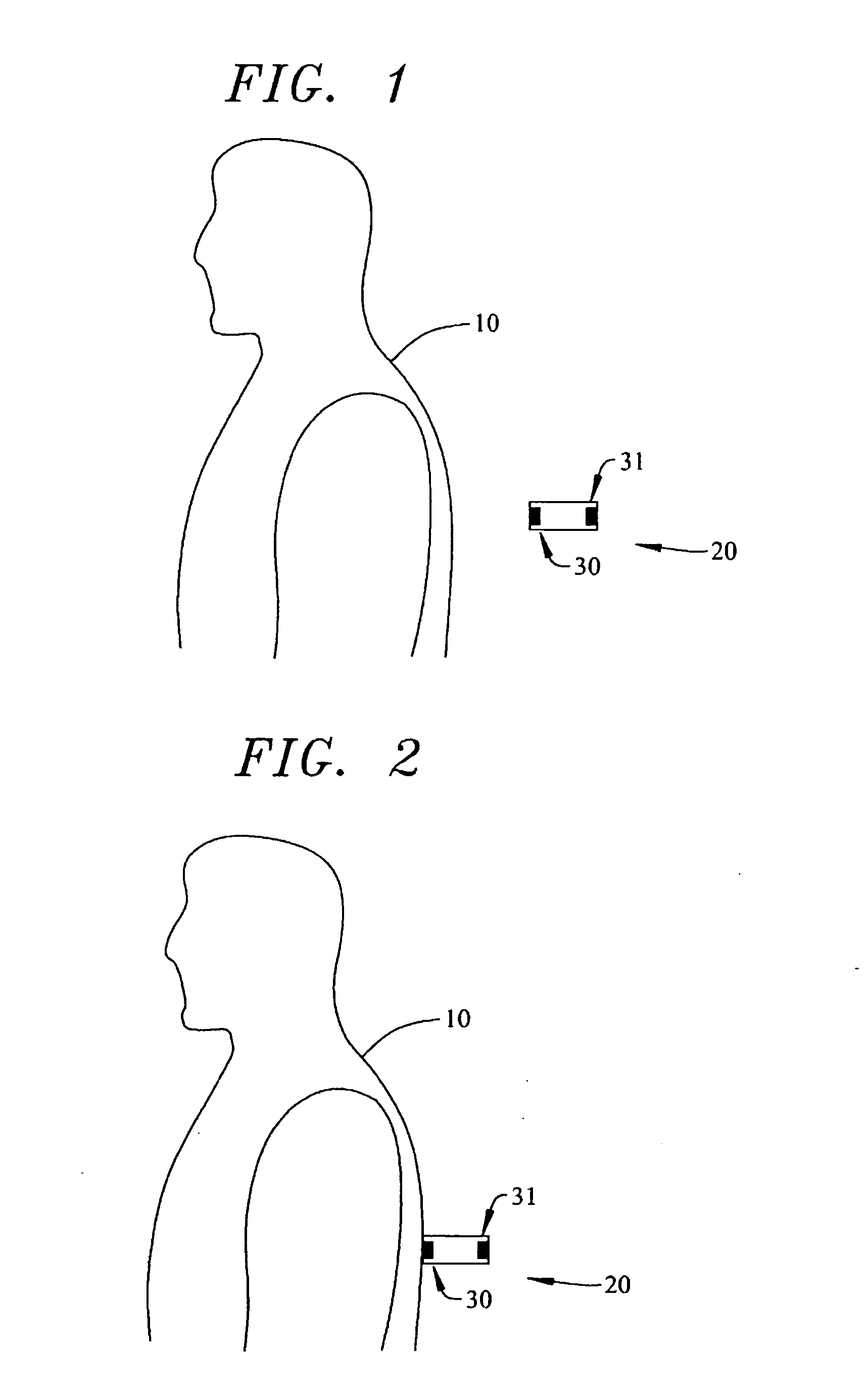 Sensor system for measurement of one or more vector components of an electric field