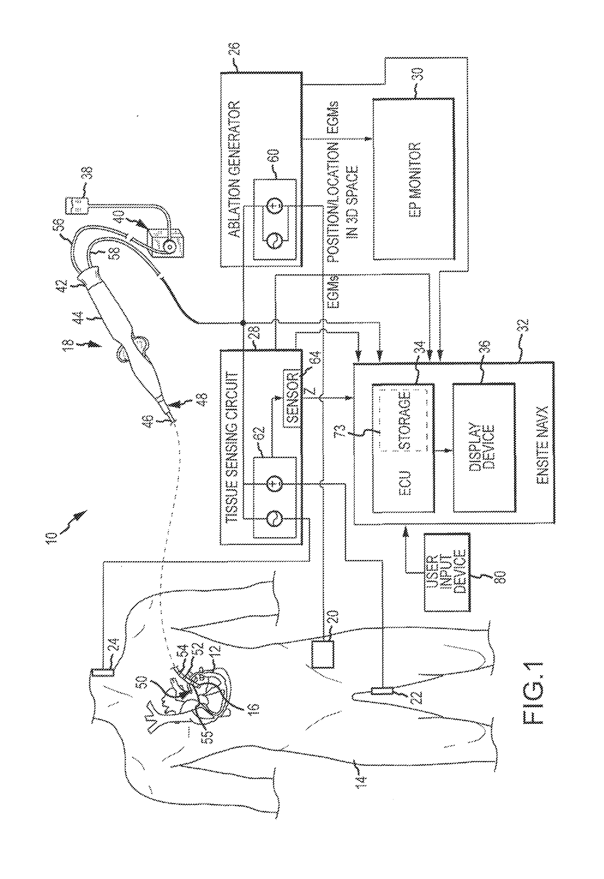 System and method for assessing the formation of a lesion in tissue