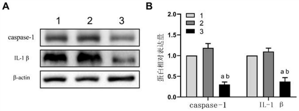 Application of EphA2 gene in preparation of product for treating or diagnosing breast cancer caused by pyroptosis-related protein