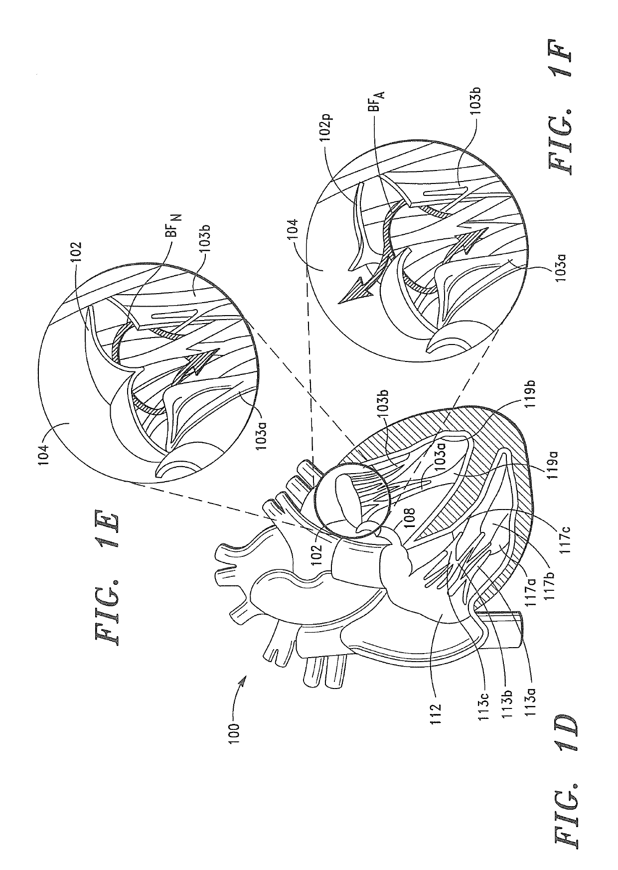 Prosthetic Tissue Valves and Methods for Replacing Native Atrioventricular Valves with Same