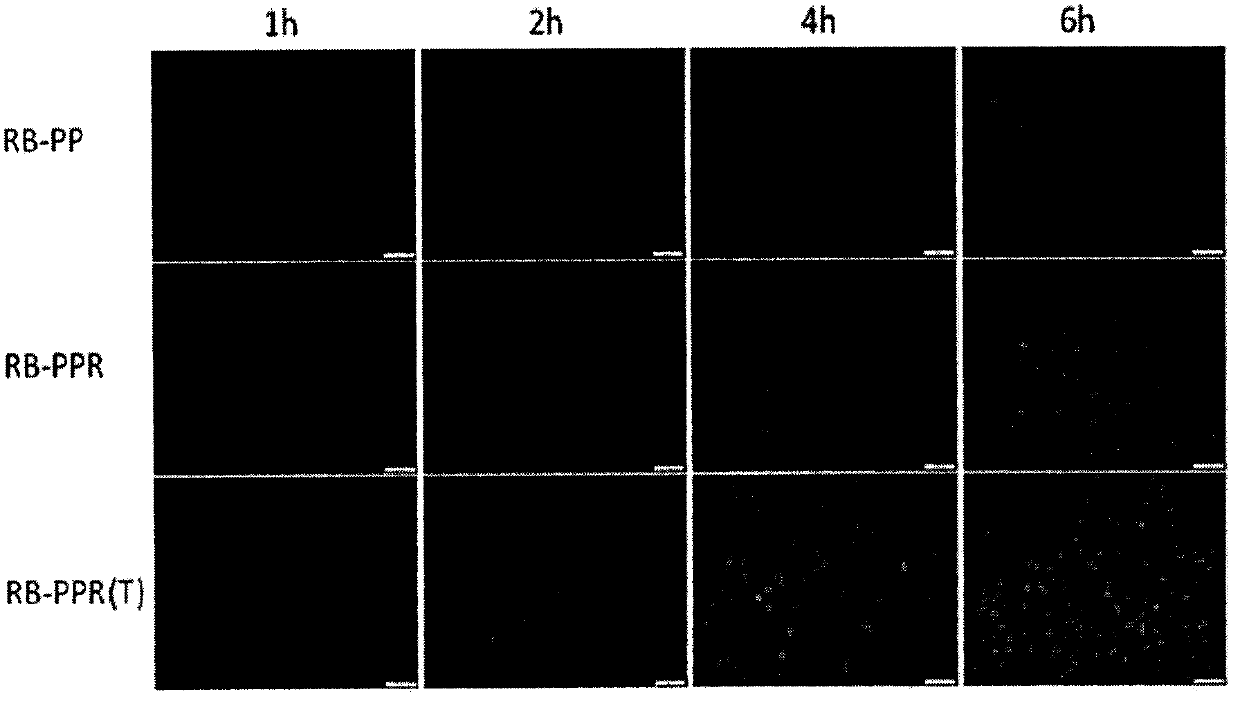 Drug delivery system targeting posterior segment of eye, formulation and preparation method thereof