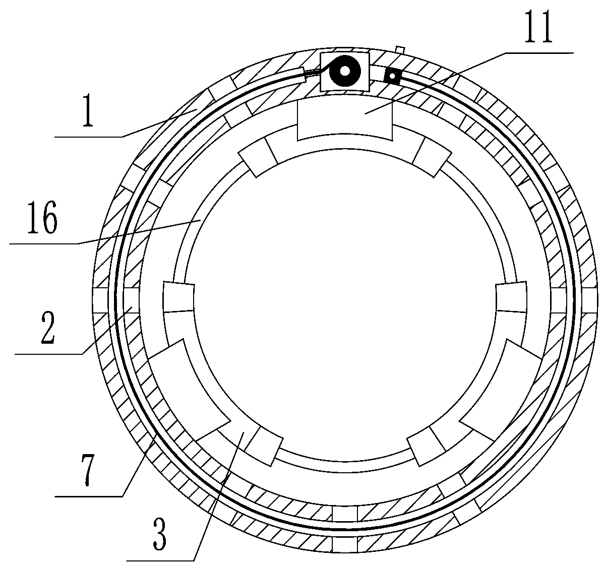 Fracture fixation protective device