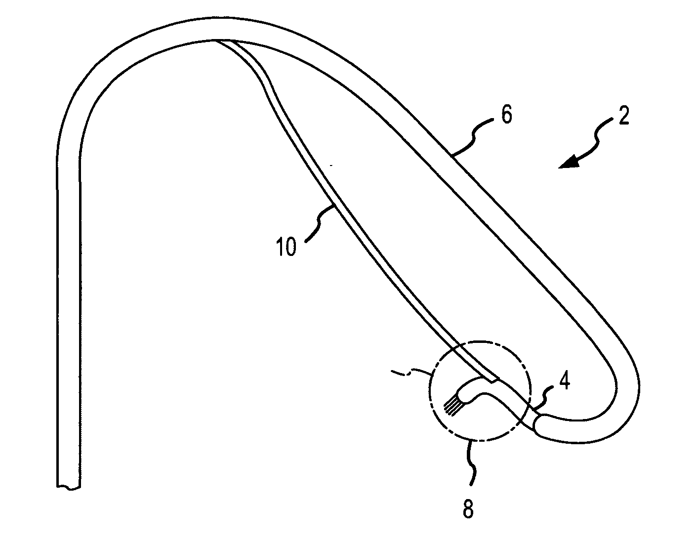 Catheter electrode and rail system for cardiac ablation