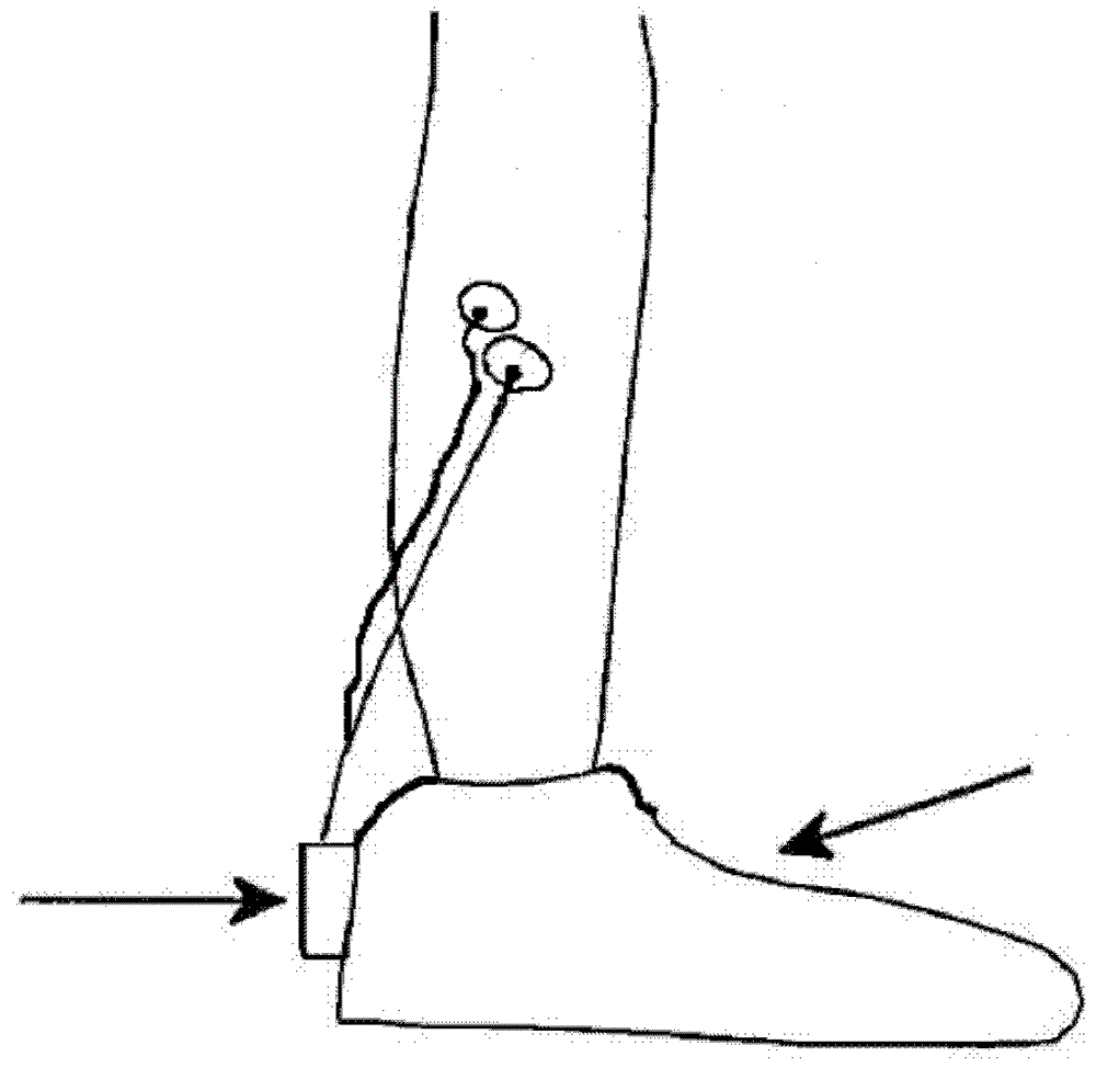 Device for preventing ankle sprains and method of use thereof