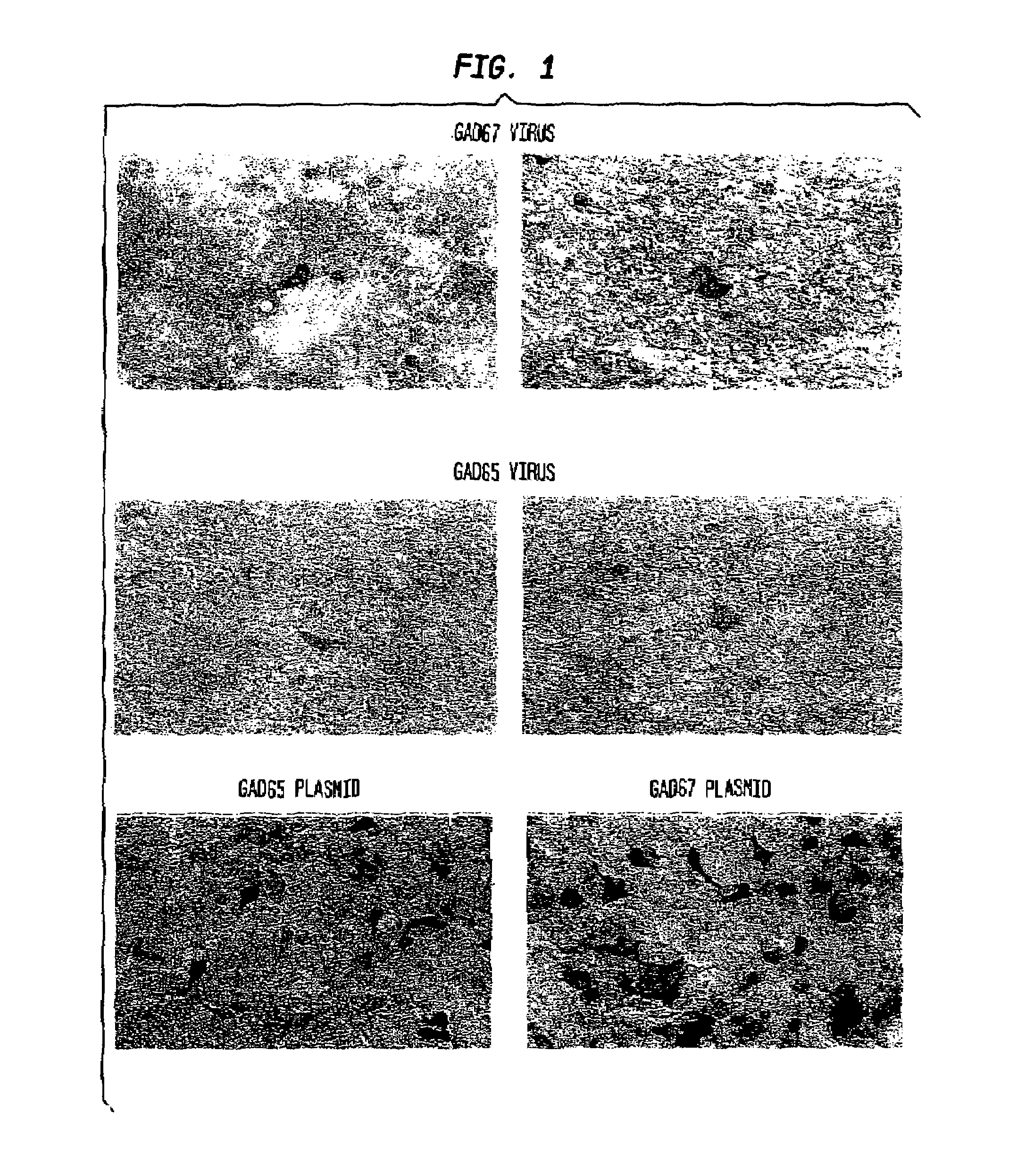 Glutamic acid decarboxylase (GAD) based delivery system