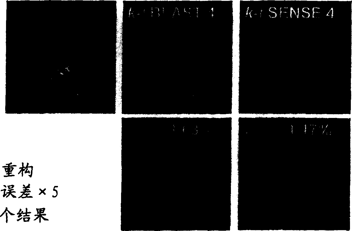 Prior-information-enhanced dynamic magnetic resonance imaging