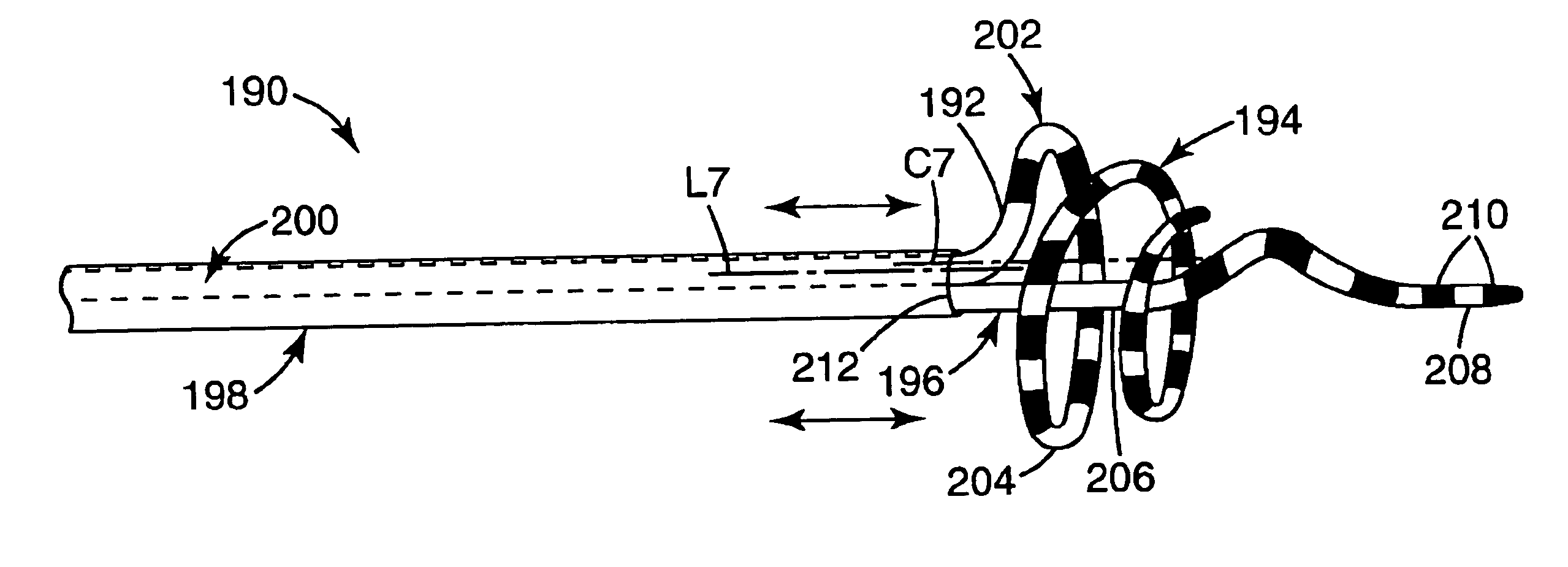 Ablation catheter and method for isolating a pulmonary vein