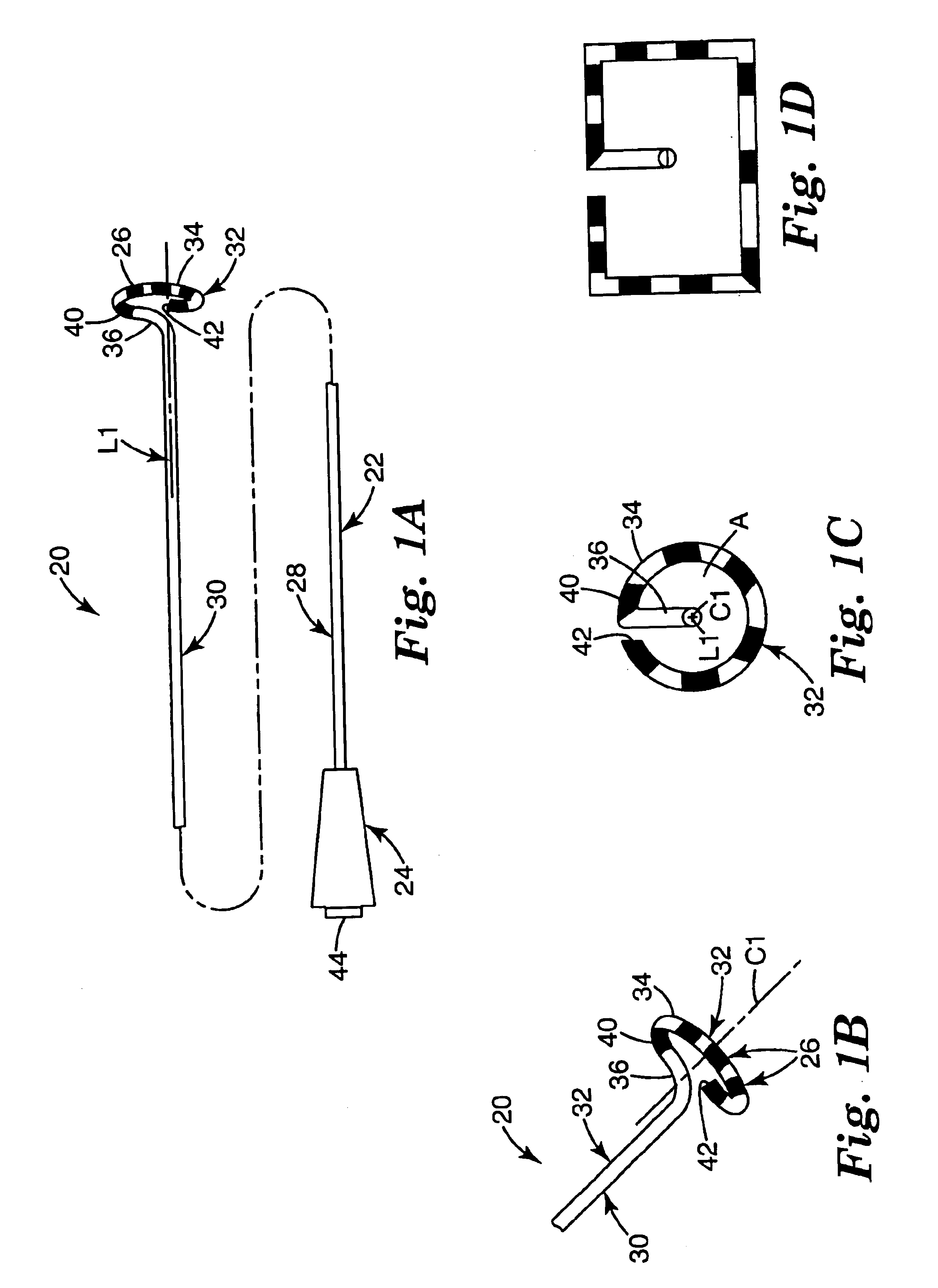 Ablation catheter and method for isolating a pulmonary vein