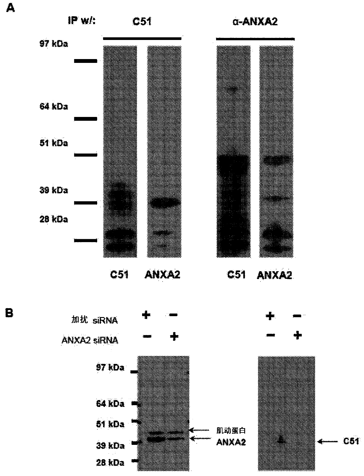 Anti-annexin a2 monoclonal antibodies
