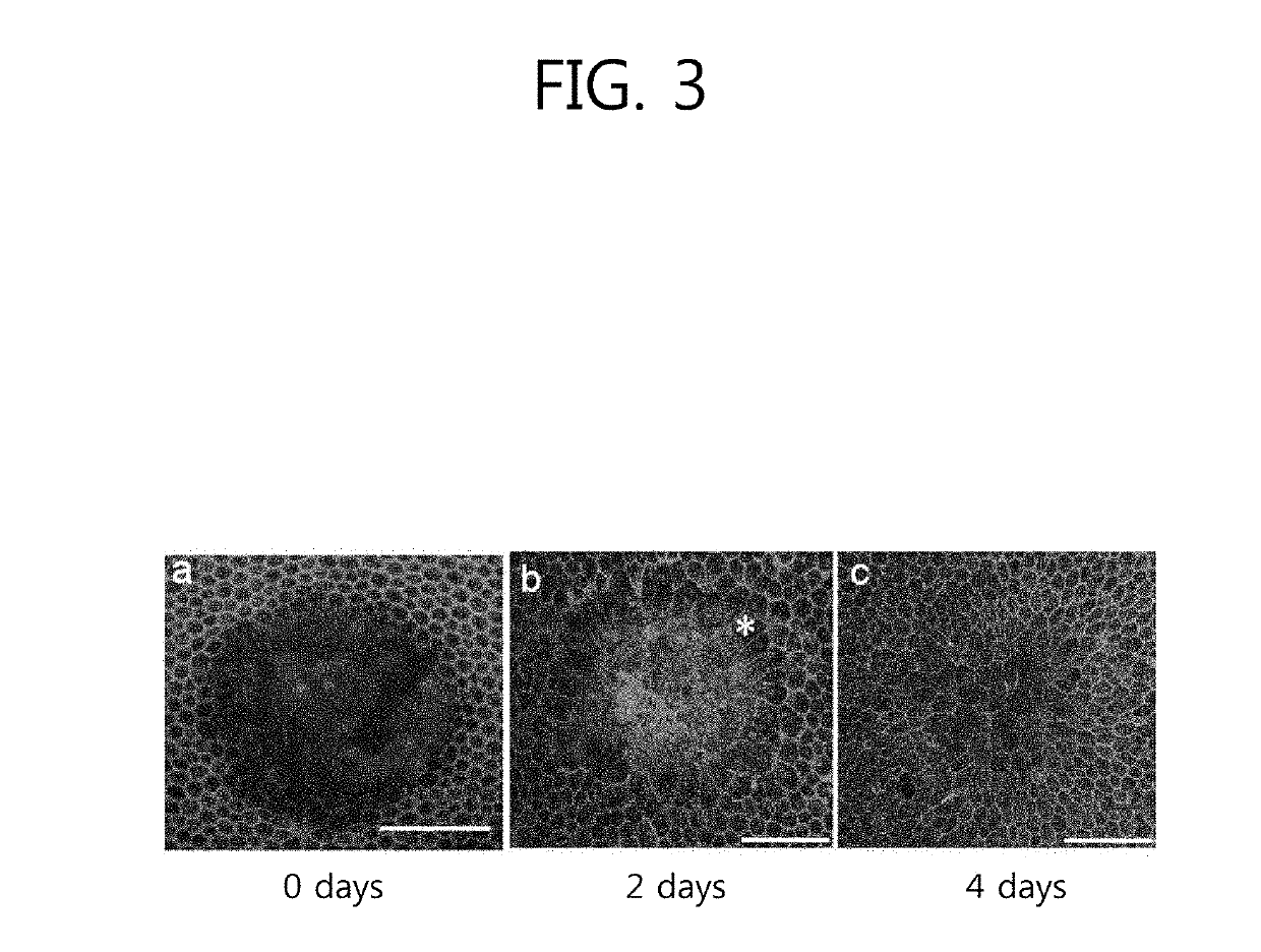 Drusen treatment method and method for controlling drusen treatment device