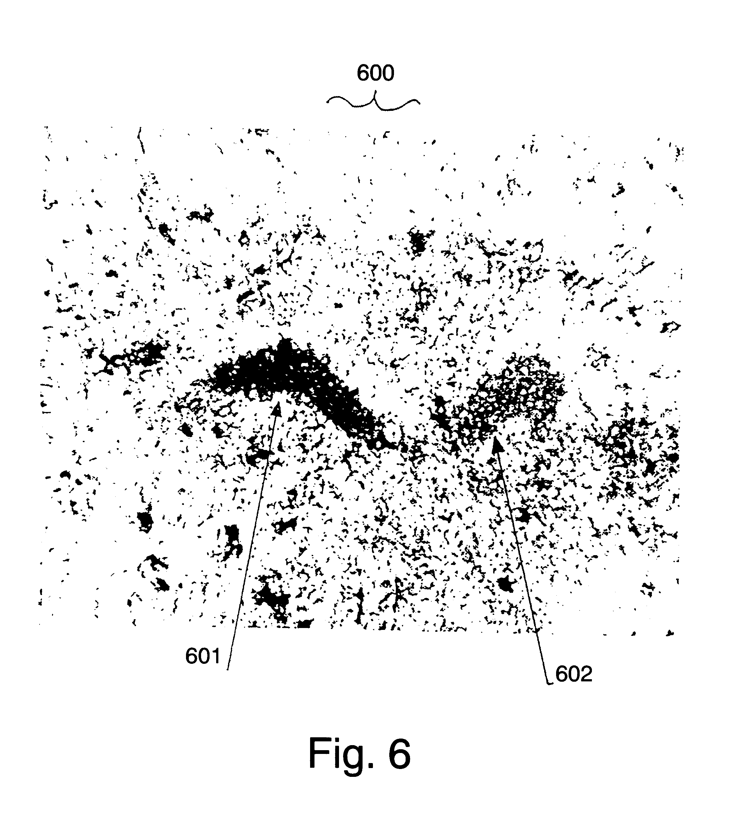 Methods to improve neural outcome