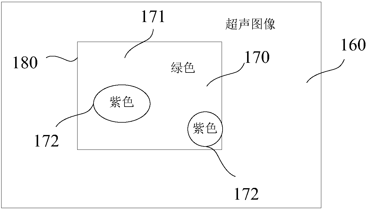 Ultrasonic elastic imaging device and elastic imaging result evaluation method