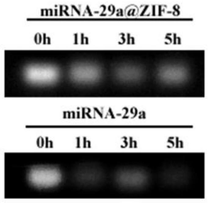 Nanoparticle composite hydrogel nerve conduit and preparation method thereof