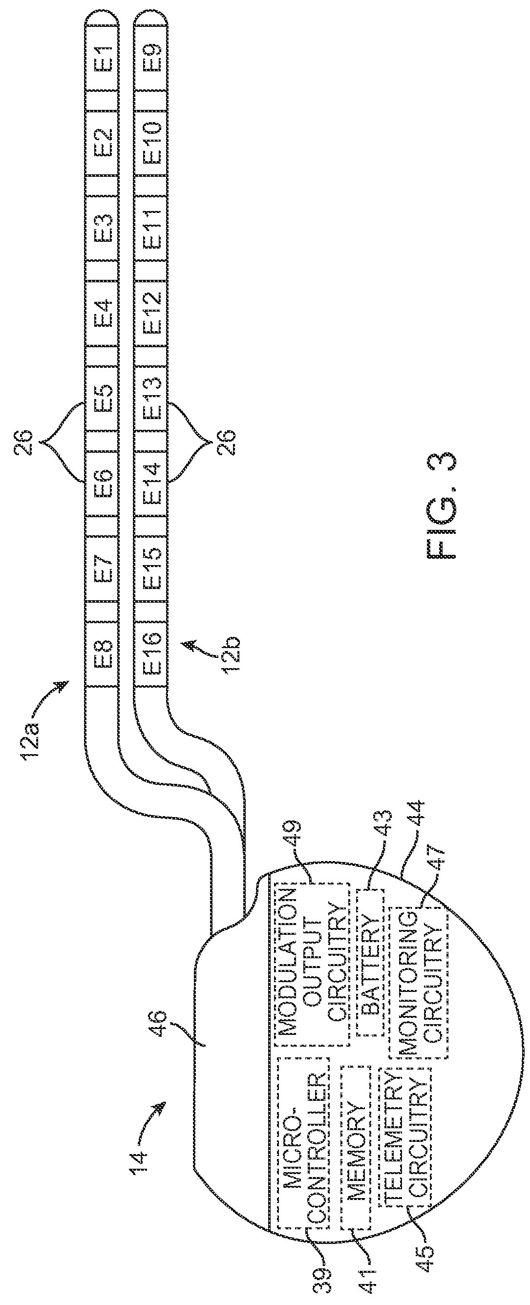 Systems and methods for delivering sub-threshold therapy to a patient at a physiological midline